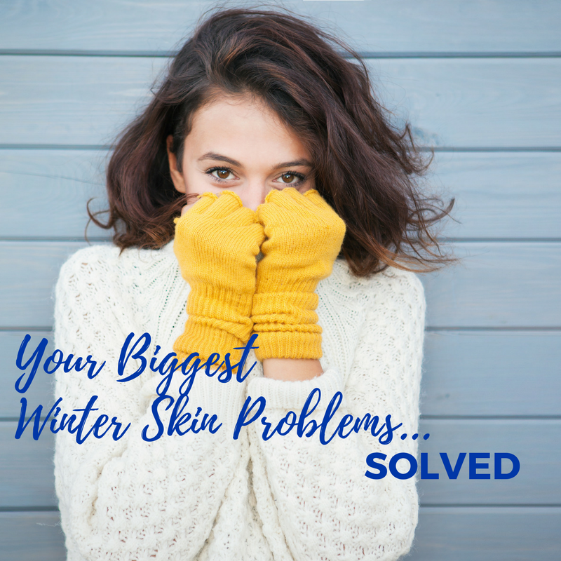4 Solutions for Your Biggest Winter Skin Problems